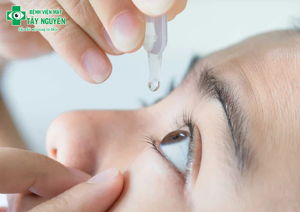 Cách sử dụng thuốc nhỏ mắt  cho bệnh nhân